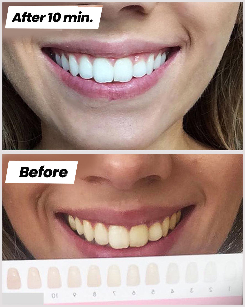 Toothpaste | ClickSmile™ - clicksmile.net 